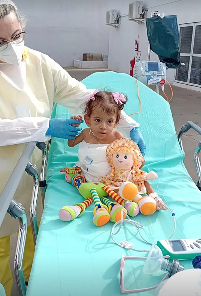 Conjoined twin who survived separation surgery diÂ£s just months after operation